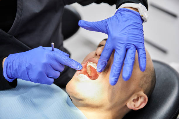 Best Urgent Tooth Repair  in Corydon, IN